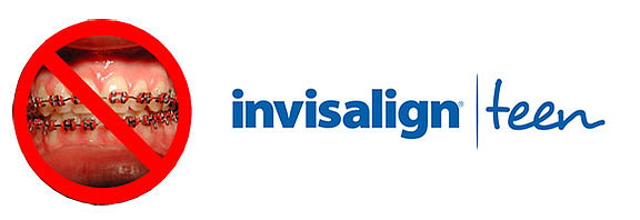 invisalign-teen.jpg 