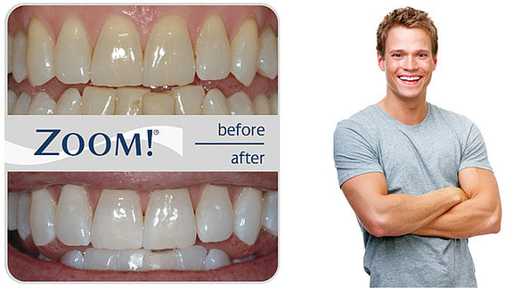 zoom-tooth-whitening-before-after.jpg 