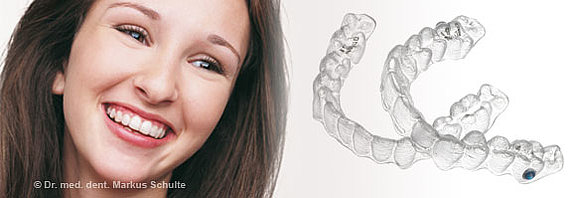 invisalign-promo.jpg 