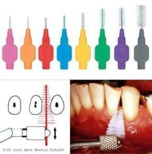 dentalhygiene_tools.jpeg 