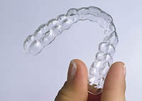 invisalign.jpg