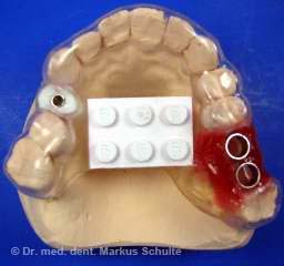 3-d-schablone.jpg