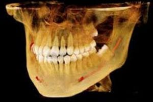DVT-300x200.jpg
