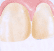 carbamidperoxid.gif
