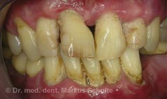 halitosis-6__3_.jpg
