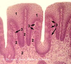 halitosis-zunge.jpg 