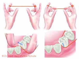 zahnseide.jpg 
